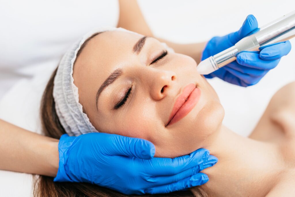 Microneedling Treatments Las Vegas & Spring Valley